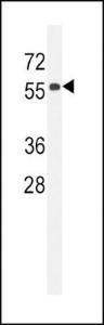 Anti-CC85C Rabbit Polyclonal Antibody (APC (Allophycocyanin))