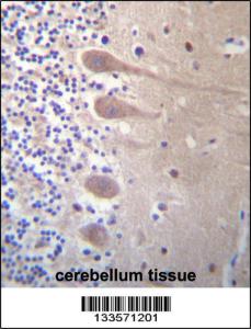 Anti-ZNF764 Rabbit Polyclonal Antibody (AP (Alkaline Phosphatase))