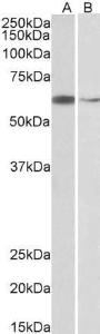 Anti-ARIH2 Antibody (A83903) (2 µg/ml) staining of Hela (A) and K562 (B) nuclear lysates (35 µg protein in RIPA buffer). Primary incubation was 1 hour. Detected by chemiluminescence