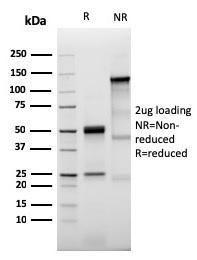 SDS-PAGE analysis of Anti-Prolactin Receptor Antibody [PRLR/3785R] under non-reduced and reduced conditions; showing intact IgG and intact heavy and light chains, respectively. SDS-PAGE analysis confirms the integrity and purity of the antibody