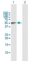 Anti-SERPINE1 Rabbit Polyclonal Antibody