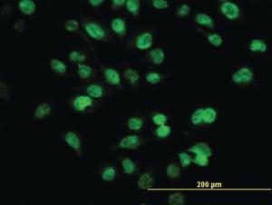 Anti-SIX4 Mouse Monoclonal Antibody [clone: 7E2]