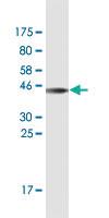 Anti-SEMA3A Mouse Monoclonal Antibody [clone: 5G9]