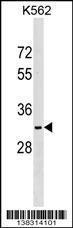 Anti-NKX6-2 Rabbit Polyclonal Antibody (APC (Allophycocyanin))