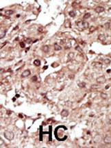 Anti-Phosphorylase Kinase Subunit gamma 1 Rabbit Polyclonal Antibody