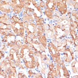 Anti-NHLRC1/Malin Rabbit Polyclonal Antibody