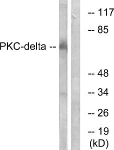 Western blot analysis of lysates from MCF7 cells using Anti-PKC delta Antibody. The right hand lane represents a negative control, where the antibody is blocked by the immunising peptide