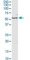 Anti-SERPINE1 Rabbit Polyclonal Antibody