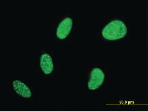 Anti-BCL7B Mouse Monoclonal Antibody [clone: 6D2]