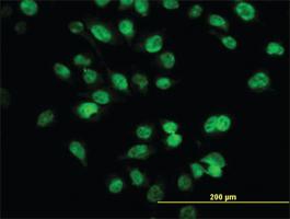 Anti-SIX4 Mouse Monoclonal Antibody [clone: 7E2]