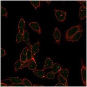 Anti-ZC3H7A antibody