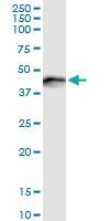 Anti-SERPINE1 Rabbit Polyclonal Antibody