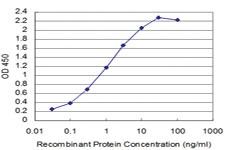 Anti-SIX4 Mouse Monoclonal Antibody [clone: 7E2]