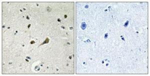 Immunohistochemical analysis of paraffin-embedded human brain using Anti-RPL39 Antibody 1:100 (4 °C overnight). The right hand panel represents a negative control, where the antibody was pre-incubated with the immunising peptide