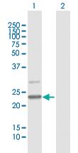 Anti-MALSU1 Mouse Polyclonal Antibody