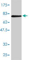 Anti-TES Mouse Monoclonal Antibody [clone: 1G11-B7]