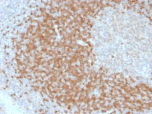 Antibody anti-TCL1 TCL12078 BSA 100 µg