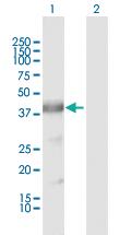 Anti-ARG2 Rabbit Polyclonal Antibody