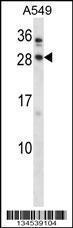 Anti-BARX1 Rabbit Polyclonal Antibody (FITC (Fluorescein Isothiocyanate))