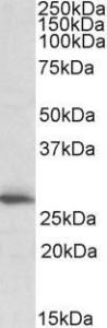 Anti-CLPP Antibody (A83906) (1 µg/ml) staining of Human Heart lysate (35 µg protein in RIPA buffer). Primary incubation was 1 hour. Detected by chemiluminescence