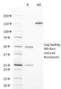 Antibody anti-TCL1 TCL12078 BSA 100 µg