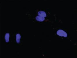 Anti-FGFR1 Antibody Pair