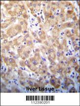 Anti-STX2 Rabbit Polyclonal Antibody (FITC (Fluorescein Isothiocyanate))