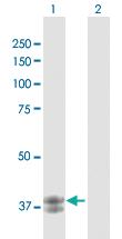 Anti-ARG2 Rabbit Polyclonal Antibody