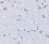 Anti-BRSK1 Rabbit Polyclonal Antibody