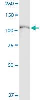 Anti-SYNJ2 Polyclonal Antibody Pair