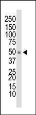 Anti-DOK1 Rabbit Polyclonal Antibody (APC (Allophycocyanin))