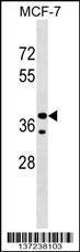 Anti-CCBE1 Rabbit Polyclonal Antibody (FITC (Fluorescein Isothiocyanate))