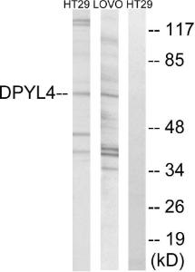 Western blot analysis of lysates from LOVO and HT-29 cells using Anti-DPYSL4 Antibody. The right hand lane represents a negative control, where the Antibody is blocked by the immunising peptide