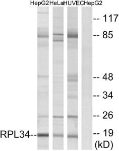 Western blot analysis of lysates from HepG HeLa, and HUVEC cells using Anti-RPL34 Antibody. The right hand lane represents a negative control, where the antibody is blocked by the immunising peptide