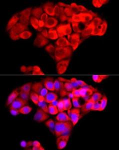 Anti-NNMT antibody