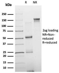 SDS-PAGE analysis of Anti-NeuroD2 Antibody [PCRP-NEUROD2-1G1] under non-reduced and reduced conditions; showing intact IgG and intact heavy and light chains, respectively. SDS-PAGE analysis confirms the integrity and purity of the antibody