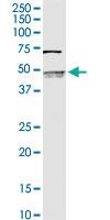 Anti-SERPINB2 Rabbit Polyclonal Antibody