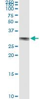 Anti-NAB2 Polyclonal Antibody Pair