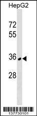 Anti-NKX6-3 Rabbit Polyclonal Antibody (HRP (Horseradish Peroxidase))