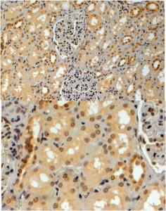 Anti-TRIM8 Antibody (A83907) (4µg/ml) staining of paraffin embedded Human Kidney. Steamed antigen retrieval with citrate buffer pH 6, HRP-staining.