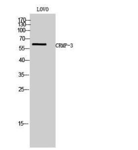 Western blot analysis of LOVO cells using Anti-DPYSL4 Antibody