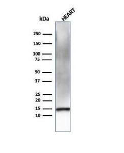 Western blot analysis of human heart tissue lysate using Anti-Resistin Antibody [RETN/4326]