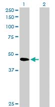 Anti-SERPINB2 Rabbit Polyclonal Antibody