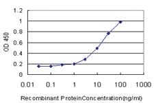 Anti-PIK3R4 Mouse Monoclonal Antibody [clone: 1B5]