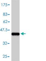 Anti-TSPO Mouse Monoclonal Antibody [clone: 3D8-B2]