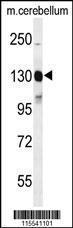 Anti-KIT Rabbit Polyclonal Antibody (Biotin)