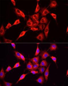 Anti-NNMT antibody