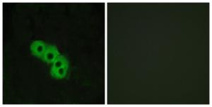 Antibody anti-GPR109 A95743-100 100 µg