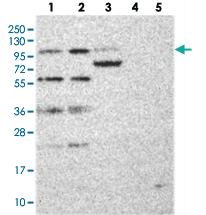 Anti-KIF18A Rabbit Polyclonal Antibody