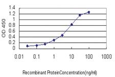 Anti-BCL7B Mouse Monoclonal Antibody [clone: 6D2]